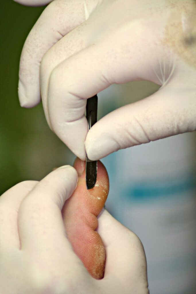 Close-up of gloved hands trimming toenail